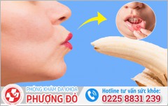 Bị nhiệt miệng quan hệ bằng miệng có sao không? Chuyên gia giải đáp