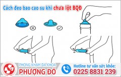 Cách đeo bao cao su khi chưa lột bao quy đầu (không tuột, không đau)