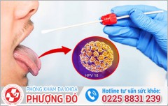 HPV có trong nước bọt không? Nguy cơ lây nhiễm & cách phòng tránh