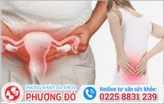 Người bị viêm phụ khoa có đau lưng không? Chuyên gia giải đáp