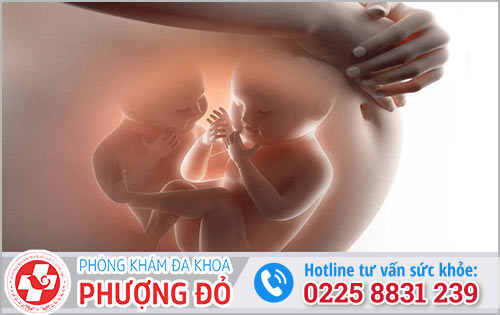 Thai song sinh hay thai đôi là thế nào?