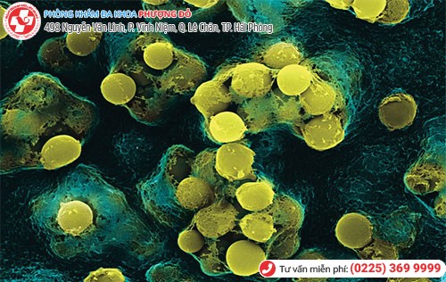 Trực khuẩn Gram âm – Haemophilus ducreyi 