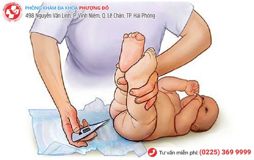 Phương pháp chữa bệnh hẹp hậu môn ở trẻ sơ sinh