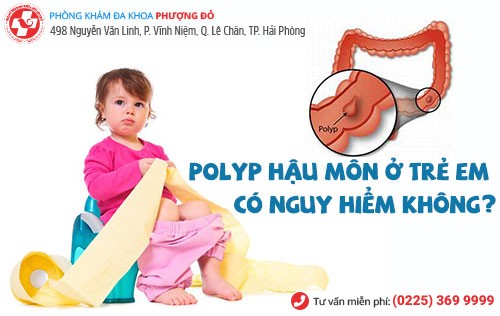 polyp hậu môn ở trẻ em
