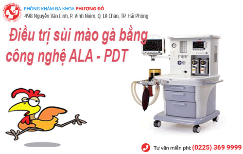 ALA-PDT phương pháp điều trị sùi mào gà an toàn và hiệu quả