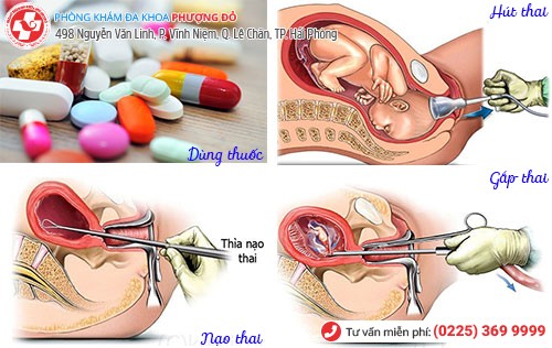 Phương pháp phá thai