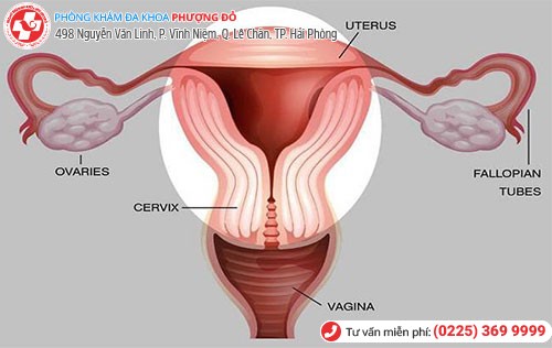 Hình ảnh bệnh dính tử cung